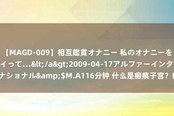 【MAGD-009】相互鑑賞オナニー 私のオナニーを見ながら、あなたもイって…</a>2009-04-17アルファーインターナショナル&$M.A116分钟 什么是瘢痕子宫？瘢痕子宫再次妊娠有哪些风险？